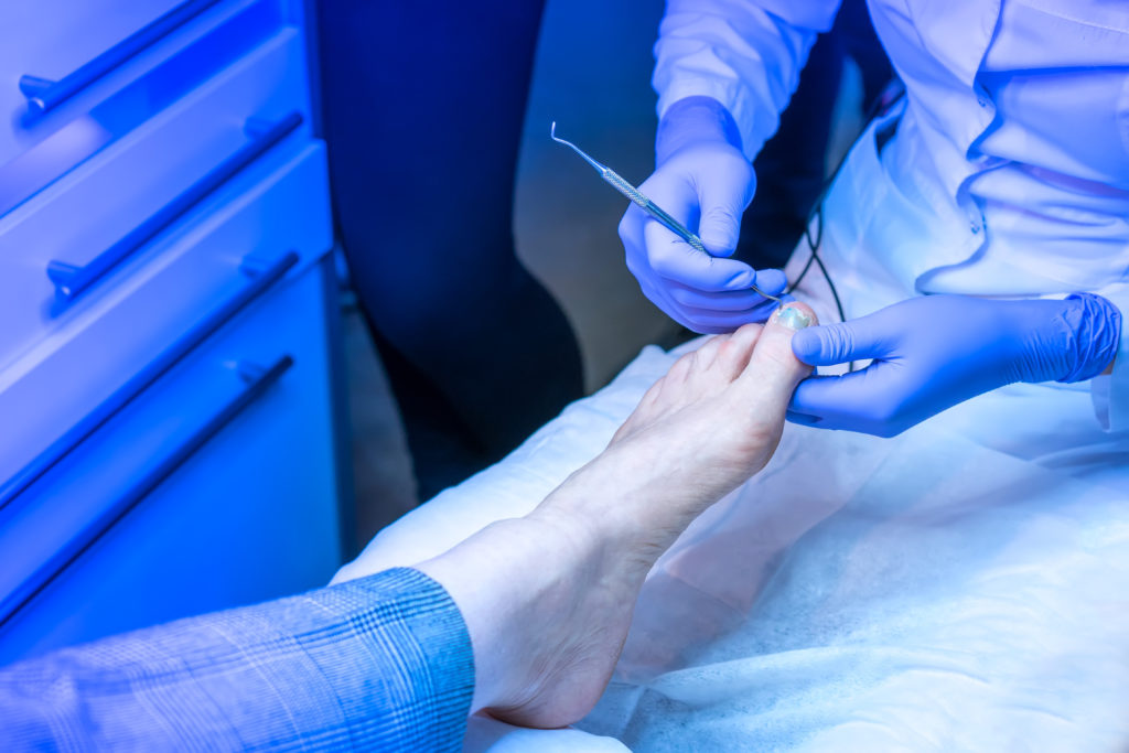 Ingrown Toenail Surgery Postsurgical Care Elizabeth E. Auger, DPM