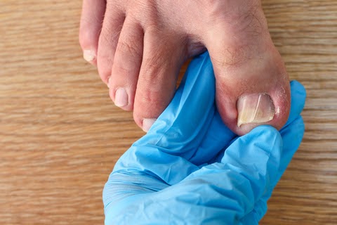 foot examination