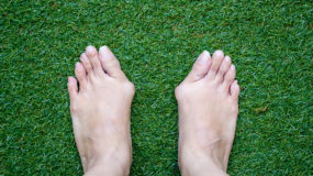 feet with bunions