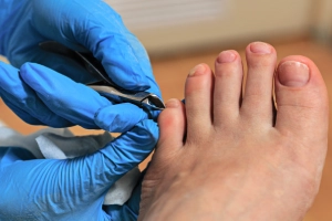 Podiatrist trimming a patient’s toenail to treat an ingrown toenail.
